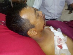 Operasi 2 Anggota Brimob Korban Teror Penusukan Berjalan Lancar