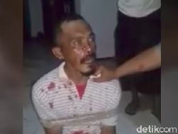 Maling Dibakar Hidup-hidup di Pamekasan, Polisi: Dia Terluka di Kaki