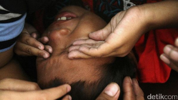 Jerit Tangis Warnai Khitanan Massal di Kemayoran