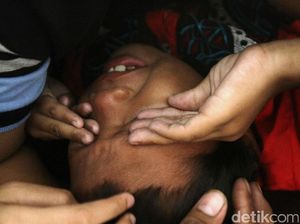 Jerit Tangis Warnai Khitanan Massal di Kemayoran