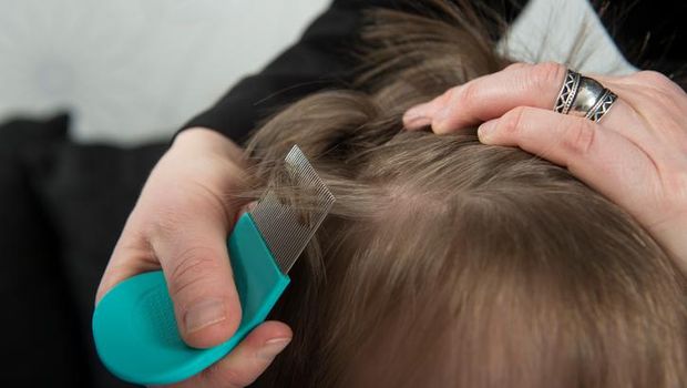 7 Fakta Kutu Rambut pada Anak yang Perlu Bunda Tahu