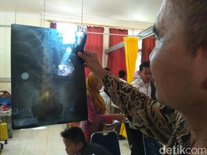 Meski Santet Tak Ada Dalam Ilmu Medis, Dokter Tetap Percaya Nggak? Meski Santet Tak Ada Dalam Ilmu Medis, Dokter Tetap Percaya Nggak?