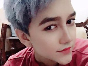 Pria Kulit Sawo Matang Habiskan Nyaris Rp 1 Miliar Demi Berubah Jadi Putih Pria Kulit Sawo Matang Habiskan Nyaris Rp 1 Miliar Demi Berubah Jadi Putih