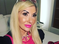 Terobsesi Jadi Barbie, Wanita Ini Operasi Bibir Agar Selalu Tersenyum