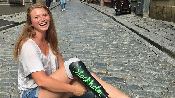 Gadis Berkaki Palsu yang Bikin Netizen Jatuh Cinta