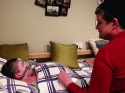 Kondisi Langka, Remaja Ini Bisa Meninggal Kalau Tertidur Sembarangan