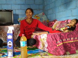 Perjuangan Hidup Bocah dari Gunungkidul yang Lumpuh Akibat Torch CMV