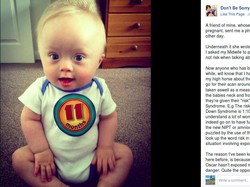 Dukungan yang Dibutuhkan Saat Mengandung Anak dengan Potensi Disabilitas