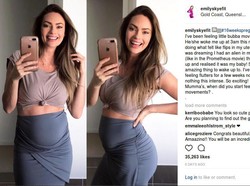 Muncul Selulit Saat Hamil, Wanita Ini Tetap Pede Narsis di Instagram