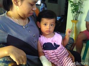 Apa Kabar Aisha Balita Korban Penyerangan Siamang di Blitar?