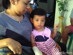 Apa Kabar Aisha Balita Korban Penyerangan Siamang di Blitar?