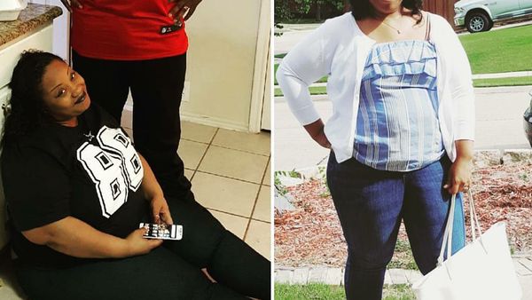 Potret Transformasi Mereka yang Menjalani Prosedur Pengecilan Payudara