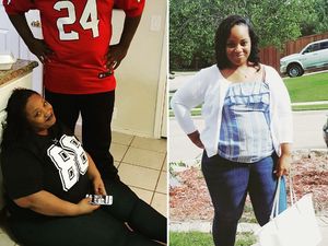 Potret Transformasi Mereka yang Menjalani Prosedur Pengecilan Payudara