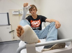 Putus Diserang Banteng, Jempol Tangan Pria Ini Diganti Jempol Kaki