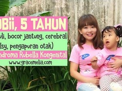 Viral Pesan Grace Melia, Ibu Ubii yang Terkena Rubella Saat Hamil