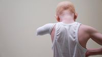 Potret Anak-anak Hantu Albino Asal Tanzania Korban Mutilasi