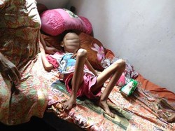 Perjuangan Petani di Blitar Obatkan Anaknya yang Sakit Leukemia