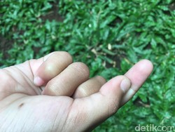 Jari Bocah di Tasik Nyangkut di Holder HP, Damkar Turun Tangan