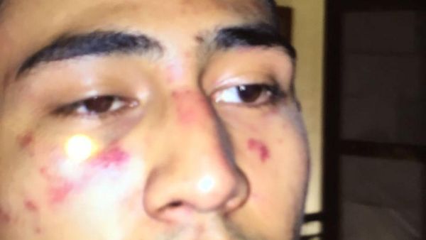 Ini Foto Babak Belur Anak Jeremy Thomas Usai Dikeroyok Oknum Polisi