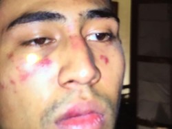 Kronologi Anak Jeremy Thomas yang Disekap dan Dikeroyok Oknum Polisi