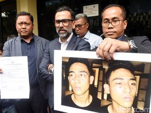 Tutupi Wajah, Axel Matthew Thomas Digiring ke Polres Bandara Soetta