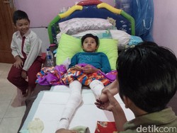 Derita Bocah Helmi yang Alami Luka Bakar saat Ikuti Kegiatan Pramuka