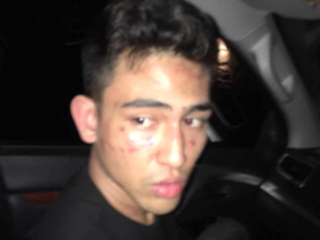 Polisi akan Kenakan UU Psikotropika terhadap Anak Jeremy Thomas Polisi akan Kenakan UU Psikotropika terhadap Anak Jeremy Thomas