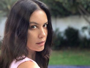 Simpati untuk Sophia Latjuba yang Tangannya Luka-luka Digigit Anjing