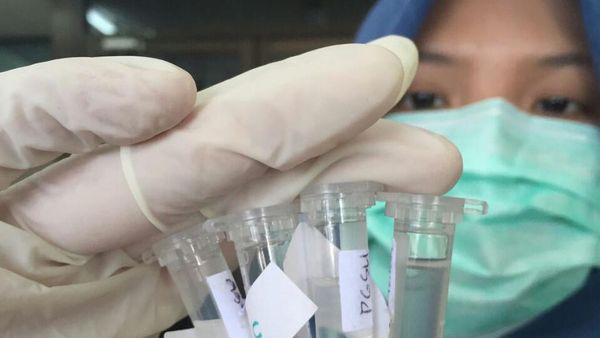 Foto: Lem Operasi Buatan Mahasiswi Unair Surabaya