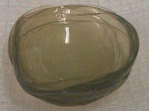 Dokter Angkat 27 Lensa Kontak dari Mata Wanita Ini