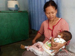 Bayi dari Keluarga Tak Mampu di Magelang ini Menderita Kelainan Hati