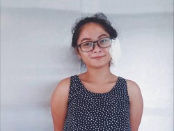 Ngeri! Gara-gara Anting Rp 15 Ribu Telinga Wanita Ini Harus Dioperasi