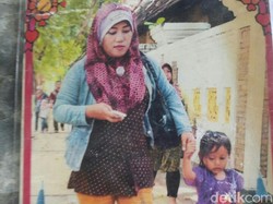 Ini Pengakuan Ibu Suci, TKW asal Pasuruan yang Disiram Air Keras