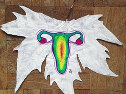 Mengenal Strecth Mark dan Solusi Mengatasinya