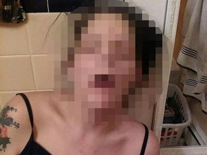 Tak Ingin Ada yang Bernasib Sama, Mantan Pecandu Share Foto Mengerikan