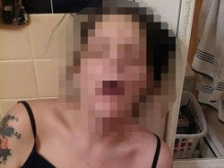 Tak Ingin Ada yang Bernasib Sama, Mantan Pecandu Share Foto Mengerikan