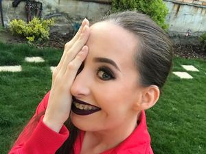 Curhat Wanita yang Hanya Punya Setengah Wajah