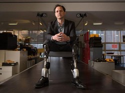 Wow, Kaki yang Diamputasi Bisa Diganti dengan Robot