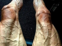 Pamer Paha Berurat usai Balapan, Pebalap Sepeda Ini Jadi Perbincangan