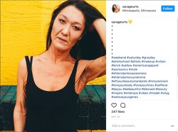 Kulit Mengendur, Pengidap Kondisi Langka Ini Tetap Bermimpi Jadi Model