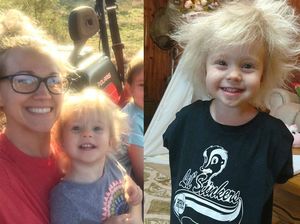 Punya Rambut Jabrik ala Einstein, Ternyata Ini Sebabnya