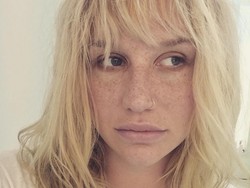 Mengejutkan, Ternyata Begini Wajah Asli Penyanyi Kesha Tanpa Makeup