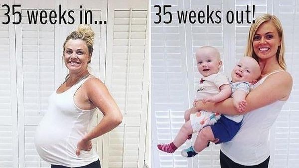 Foto: Cute! Metamorfosis Sebelum dan Sesudah si Kecil Lahir