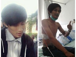 Curhat Seorang Istri yang Paru-paru Suaminya Harus Dibor Karena Rokok