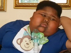 Alami Kelainan, Bocah Ini Bisa Makan Tisu