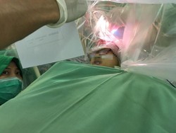 Begini Tantangan Tim Dokter Surabaya Saat Utak-Atik Pasien Tumor Otak