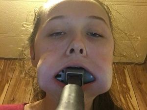 Iseng Banget! Remaja Ini Masukkan Martil ke Mulut, Lalu Nyangkut