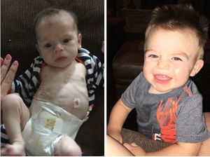 Potret Transformasi Bayi yang Kecanduan Narkoba Sebelum dan Sesudah Rehab