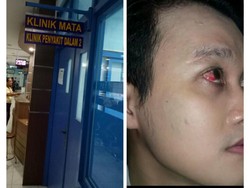 Korban Pemukulan Driver Grab Minta Pelaku Ditangkap