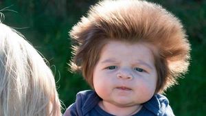 Foto: 10 Bayi yang Terlahir dengan Rambut Unik, Gemas!